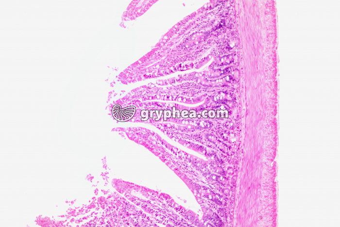 Paroi intestinale x25 - gryphea.org